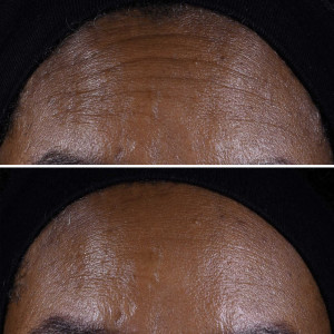 Smart Clinical Repair - Straffende Gesichts- und Halscreme